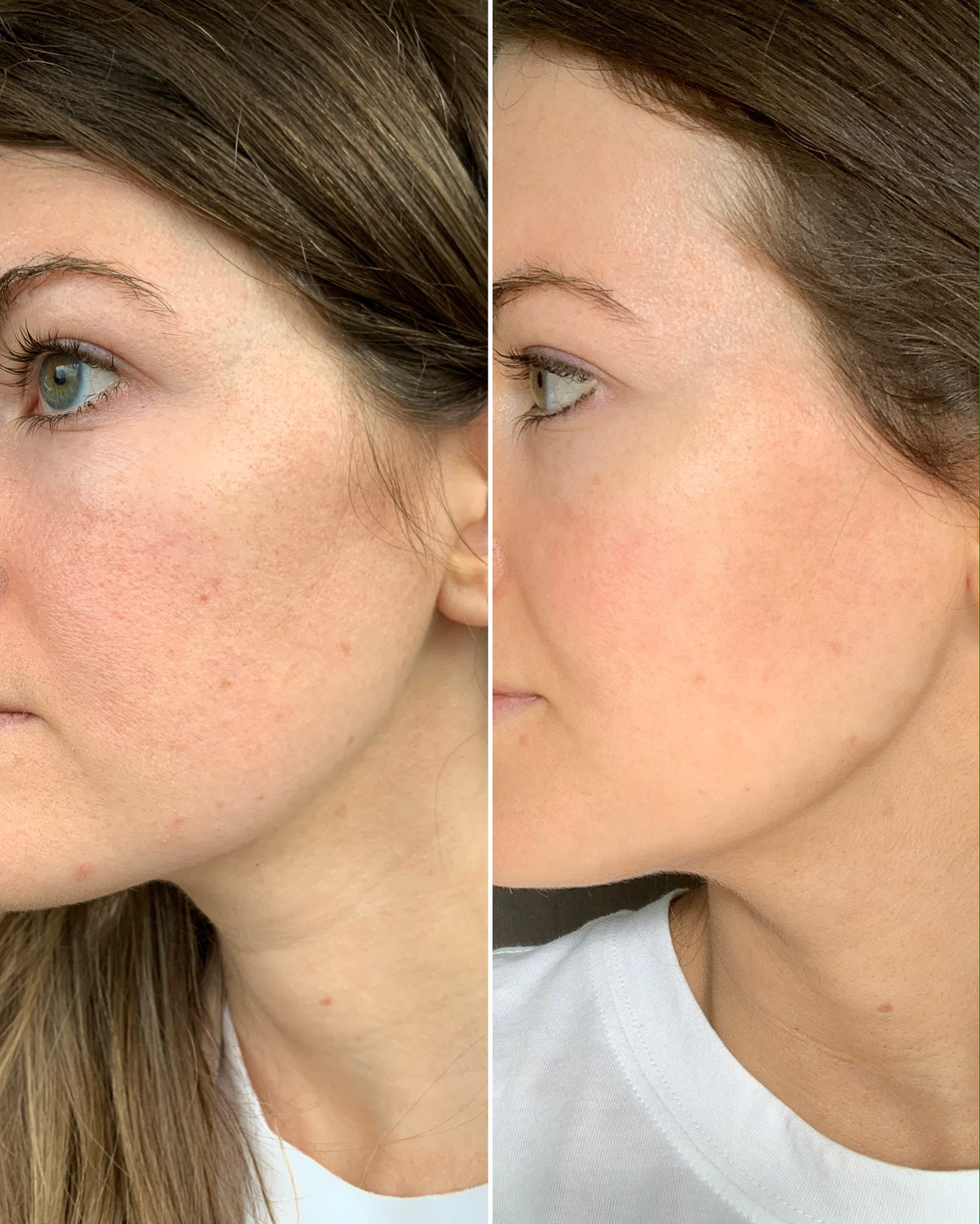 My Experience Using Olay Retinol24 (Before & After Photos!) Southern Curls & Pearls
